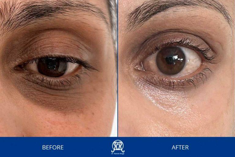 Case 9: Dark Circles