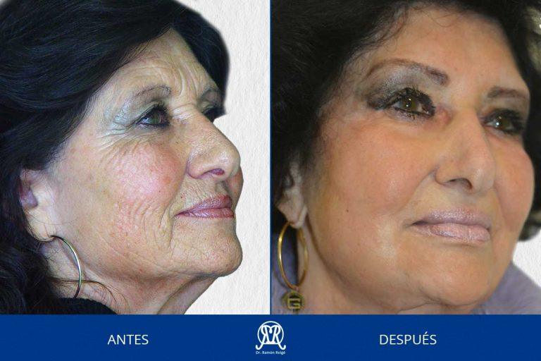 Molding-mask-principal--20anos-completo-drramonroige