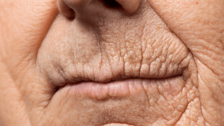 ageing-why-wrinkles-appear