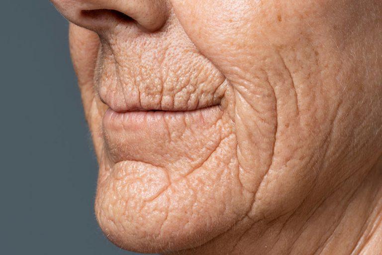 intrinsic and extrinsic skin aging-2