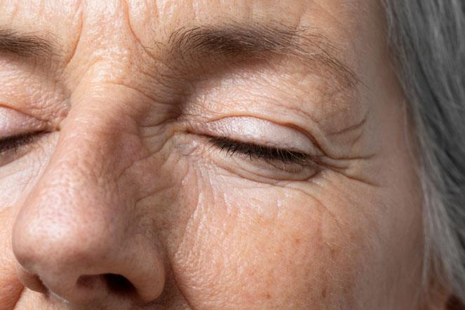 intrinsic and extrinsic skin aging-5