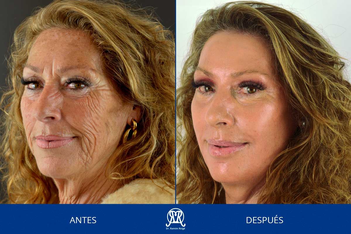 MoldingMask-drramonroige-1