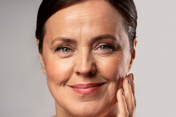 arrugas-drramonroige-destacado